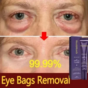Instant Eye Bag Removal
