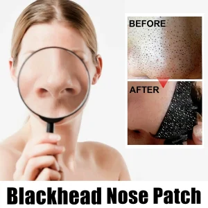 Blackhead Remover